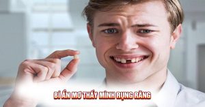 Khám Phá Bí Ẩn Mơ Thấy Mình Rụng Răng: Điềm Báo Gì?