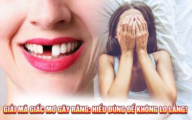 Giải Mã Giấc Mơ Gãy Răng: Sự Thật Sau Giấc Mơ Đáng Sợ Này!